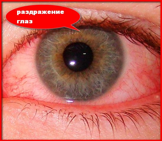 раздражение глаз из за стекловаты