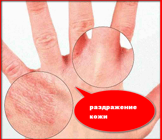 раздражения кожи из за стекловаты